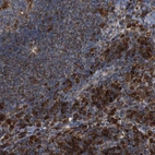 Anti-PTPN1 Antibody