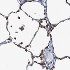 Immunohistochemical staining of human lung shows moderate cytoplasmic positivity in macrophages.