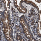 Immunohistochemical staining of human duodenum shows moderate cytoplasmic positivity in glandular cells.