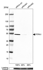 Western blot analysis in U-138MG cells transfected with control siRNA, target specific siRNA probe #1 and #2, using Anti-PTPN1 antibody. Remaining relative intensity is presented. Loading control: Anti-PPIB.
