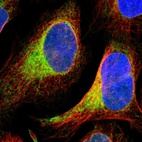 Immunofluorescent staining of human cell line U-2 OS shows positivity in endoplasmic reticulum.