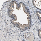 Immunohistochemical staining of human prostate shows weak cytoplasmic positivity in glandular cells.