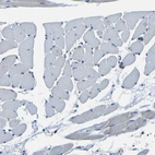 Immunohistochemical staining of human skeletal muscle shows no positivity in myocytes as expected.