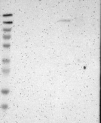 Anti-FNDC3A Antibody