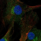 Immunofluorescent staining of human cell line BJ shows localization to nucleoplasm, cytosol & the Golgi apparatus.