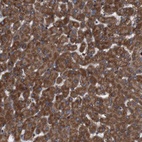 Anti-SIGLEC8 Antibody