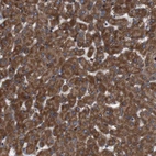 Anti-SIGLEC8 Antibody