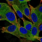 Immunofluorescent staining of human cell line SH-SY5Y shows localization to cytosol.