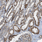 Immunohistochemical staining of human kidney shows strong granular cytoplasmic positivity in cells in tubules.