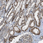 Immunohistochemical staining of human kidney shows strong granular cytoplasmic positivity in cells in tubules.