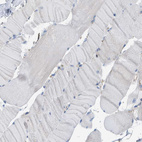 Immunohistochemical staining of human skeletal muscle shows no positivity in myocytes as expected.