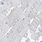 Immunohistochemical staining of human skeletal muscle shows no positivity in myocytes as expected.