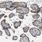 Immunohistochemical staining of human placenta shows moderate membranous positivity in trophoblastic cells.