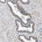 Immunohistochemical staining of human prostate shows weak to moderate membranous positivity in glandular cells.