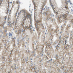 Immunohistochemical staining of human stomach shows moderate membranous positivity in glandular cells.