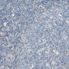 Immunohistochemical staining of human tonsil shows no positivity in lymphoid cells as expected.