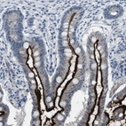 Anti-CDHR2 Antibody