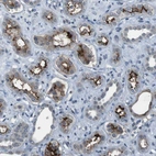 Immunohistochemical staining of human kidney shows moderate to strong membranous positivity in cells in tubules.