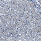 Immunohistochemical staining of human liver shows moderate to strong membranous positivity in hepatocytes.
