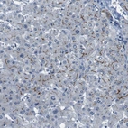Immunohistochemical staining of human liver shows moderate to strong membranous positivity in hepatocytes.
