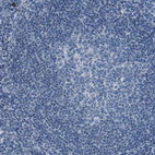 Immunohistochemical staining of human tonsil shows no membranous positivity as expected.