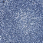 Immunohistochemical staining of human tonsil shows no membranous positivity as expected.