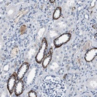 Anti-GRAMD1A Antibody