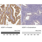 Anti-AZGP1 Antibody