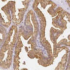 Immunohistochemical staining of human prostate shows high expression.