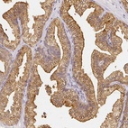 Anti-AZGP1 Antibody