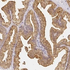 Immunohistochemical staining of human prostate shows high expression.