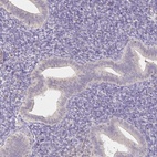 Anti-AZGP1 Antibody