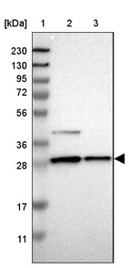 Lane 1: Marker [kDa] 230, 130, 95, 72, 56, 36, 28, 17, 11_br/_Lane 2: Human cell line RT-4_br/_Lane 3: Human cell line U-251MG sp