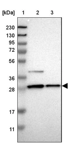 Lane 1: Marker [kDa] 230, 130, 95, 72, 56, 36, 28, 17, 11_br/_Lane 2: Human cell line RT-4_br/_Lane 3: Human cell line U-251MG sp