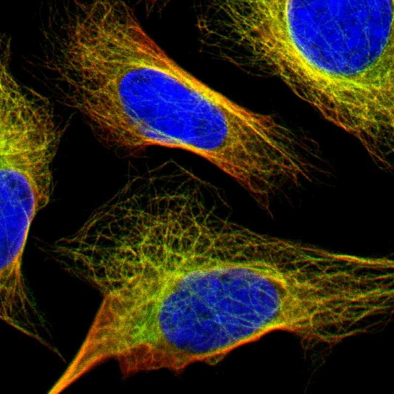 Anti-FBXO30 Antibody
