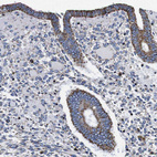 Immunohistochemical staining of human endometrium shows strong granular cytoplasmic positivity in glandular cells.