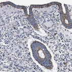 Immunohistochemical staining of human endometrium shows strong granular cytoplasmic positivity in glandular cells.