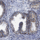 Immunohistochemical staining of human prostate shows moderate granular cytoplasmic positivity in glandular cells.