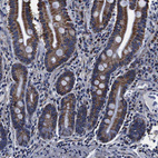 Immunohistochemical staining of human gastrointestinal shows strong granular cytoplasmic positivity in glandular cells.