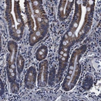 Immunohistochemical staining of human gastrointestinal shows strong granular cytoplasmic positivity in glandular cells.