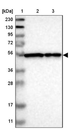 Lane 1: Marker [kDa] 230, 130, 95, 72, 56, 36, 28, 17, 11_br/_Lane 2: Human cell line RT-4_br/_Lane 3: Human cell line U-251MG sp