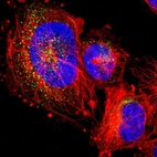 Immunofluorescent staining of human cell line U-251 MG shows localization to vesicles.