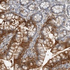 Anti-FABP6 Antibody