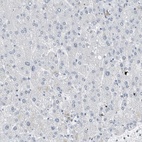 Immunohistochemical staining of human liver shows low expression as expected.