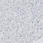 Immunohistochemical staining of human liver shows low expression as expected.