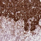 Immunohistochemical staining of human adrenal gland shows strong cytoplasmic positivity in neuroendocrine cells.