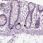 Immunohistochemical staining of human colon shows strong cytoplasmic positivity in enteroendocrine cells.