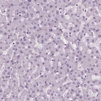 Immunohistochemical staining of human liver shows no positivity in hepatocytes as expected.