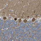 Immunohistochemical staining of human cerebellum shows strong cytoplasmic positivity in Purkinje cells.