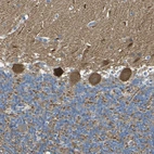 Immunohistochemical staining of human cerebellum shows strong cytoplasmic positivity in Purkinje cells.